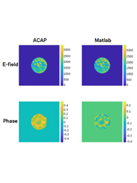 Four plots compare ACAP and Matlab E-field (blue-yellow) and Phase (cyan-orange) data, showing circular patterns.